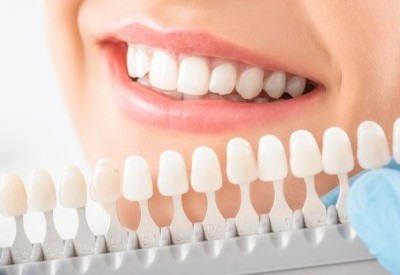 TEETH WHITENING